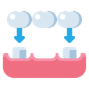 جسور الأسنان