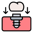 أيقونة جراحة زراعة الأسنان