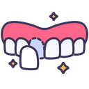 قشور الأسنان