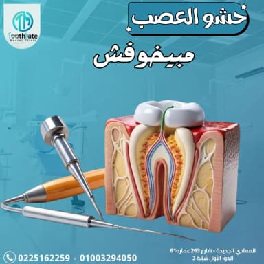 صورة لحشو العصب في عيادة توث ميت